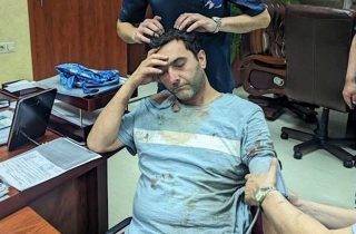 Ոստիկանները կոտրել են Աբրահամ Գասպարյանի կողոսկրերը, արնաշաղախ գլխով տեղափոխել են բաժին. Լրագրողի կինը մանրամասներ է հայտնել