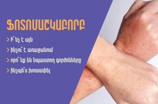 Ինչպե՞ս խուսափել ֆոտոմաշկաբորբից. Հովհաննես Հովհաննիսյան