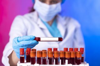 Առանց արյուն վերցնելու՝ մածուցիկության չափում. Միսսուրիի գիտնականների հայտնագործությունը