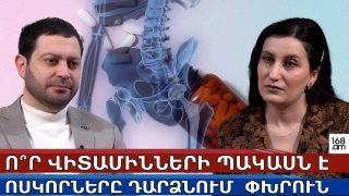Ինչո՞ւ են ոսկորները հեշտ կոտրվում․ ո՞ր վիտամինների պակասն է պատճառը