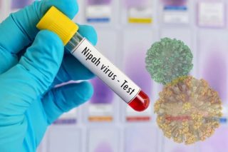 ԱՀԿ-ն Հնդկաստանից դուրս Նիպա վիրուսի տարածման ռիսկը ցածր է համարում