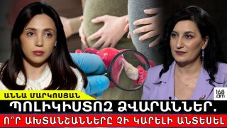 Կանանց 12 տոկոսը տառապում է այս խնդրով․ ի՞նչ են հուշում մաշկի սևացումը, մազաթափությունը, մազակալումը