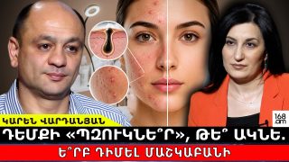 Դեմքի «պզուկնե՞ր», թե՞ ակնե․ ե՞րբ դիմել մաշկաբանի և ինչի՞ց խուսափել