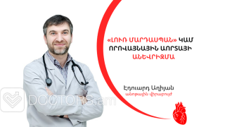 «Լուռ մարդասպան» կամ որովայնային աորտայի անևրիզմա
