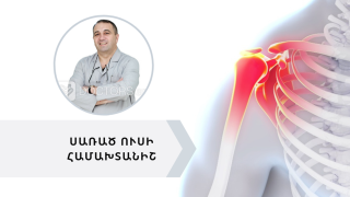 Սառած ուսի համախտանիշ. ի՞նչ է դա և ինչպե՞ս է բուժվում