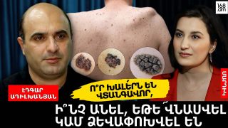 Ո՞ր խալերն են վտանգավոր, ի՞նչ անել, եթե վնասվել կամ ձևափոխվել են
